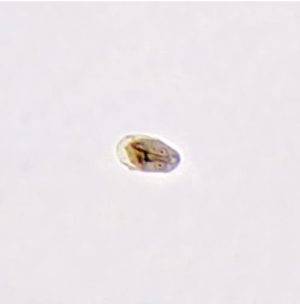 LAMINA FIJA GIARDIA LAMBLIA 295756