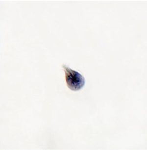 LAMINA FIJA ZOOMASTIGOTES (GIARDIA, LEISHMANIA, TRICHONOMAS, TRYPANOSOMA) 295762
