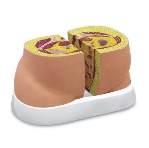 MODELO DE OBESIDAD WA25908 NASCO