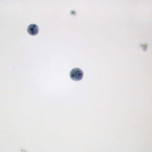 LAMINA ENTAMOEBA HISTOLYTICA 295468 CAROLINA BIOLOGICAL