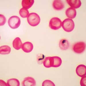 LAMINA PLASMODIUM FALCIPARUM 297190 CAROLINA BIOLOGICAL