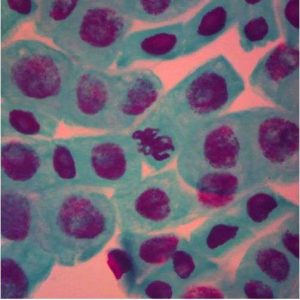 LAMINA FIJA DE ONION ROOT TIP MITOSIS SQUASH #302432