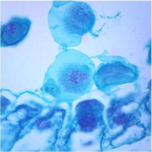 LAMINA FIJA DE LILY ANTHER SECOND MEIOTIC DIVISION SLIDE #304568