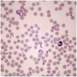 LAMINA FIJA TRYPANOSOMA CRUZI BLOOD WM 295798