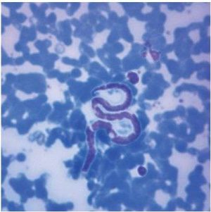 LAMINA FIJA DIROFILARIA IMMITIS SMEAR 306966
