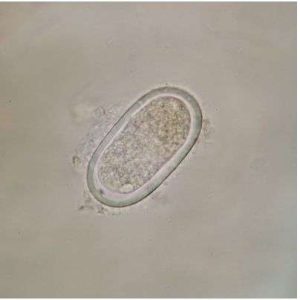 LAMINA FIJA ENTEROBIUS VERMICULARIS OVA WM 306978