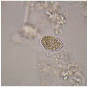 LAMINA FIJA NECATOR AMERICANUS OVA WM 306996