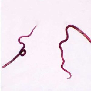 LAMINA FIJA TRICHINELLA ENCYST LARVAE SEC 307044