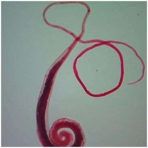 LAMINA FUJA TRICHURIS OVA WM 307056